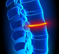 Lumbar-disc