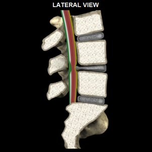 Spinal-Stenosis