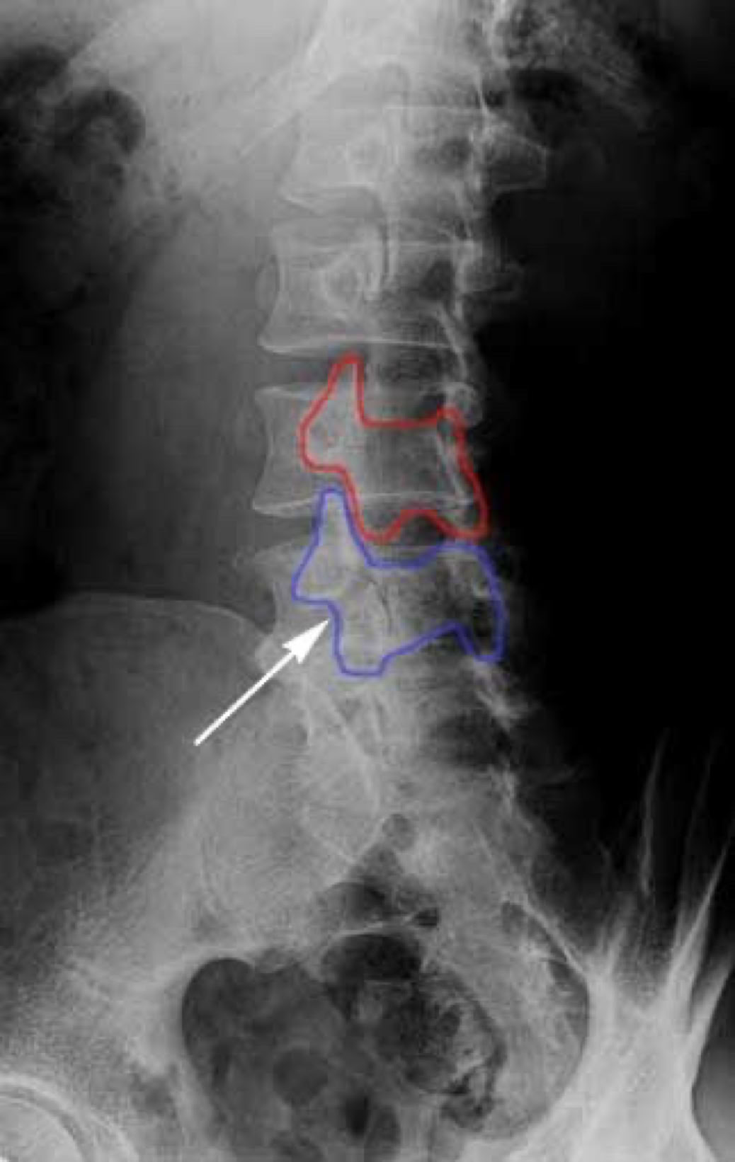 pars on an xrays or as we call it scotty dog